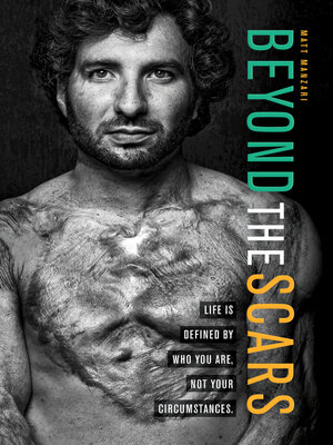 cover image of Beyond the Scars